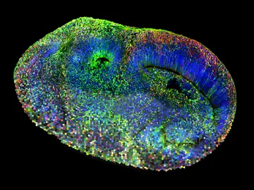 Imagen de un sistema de mosaico de organoides cerebrales humanos CHOOSE Imagen de un sistema de mosaico de organoides cerebrales humanos CHOOSE