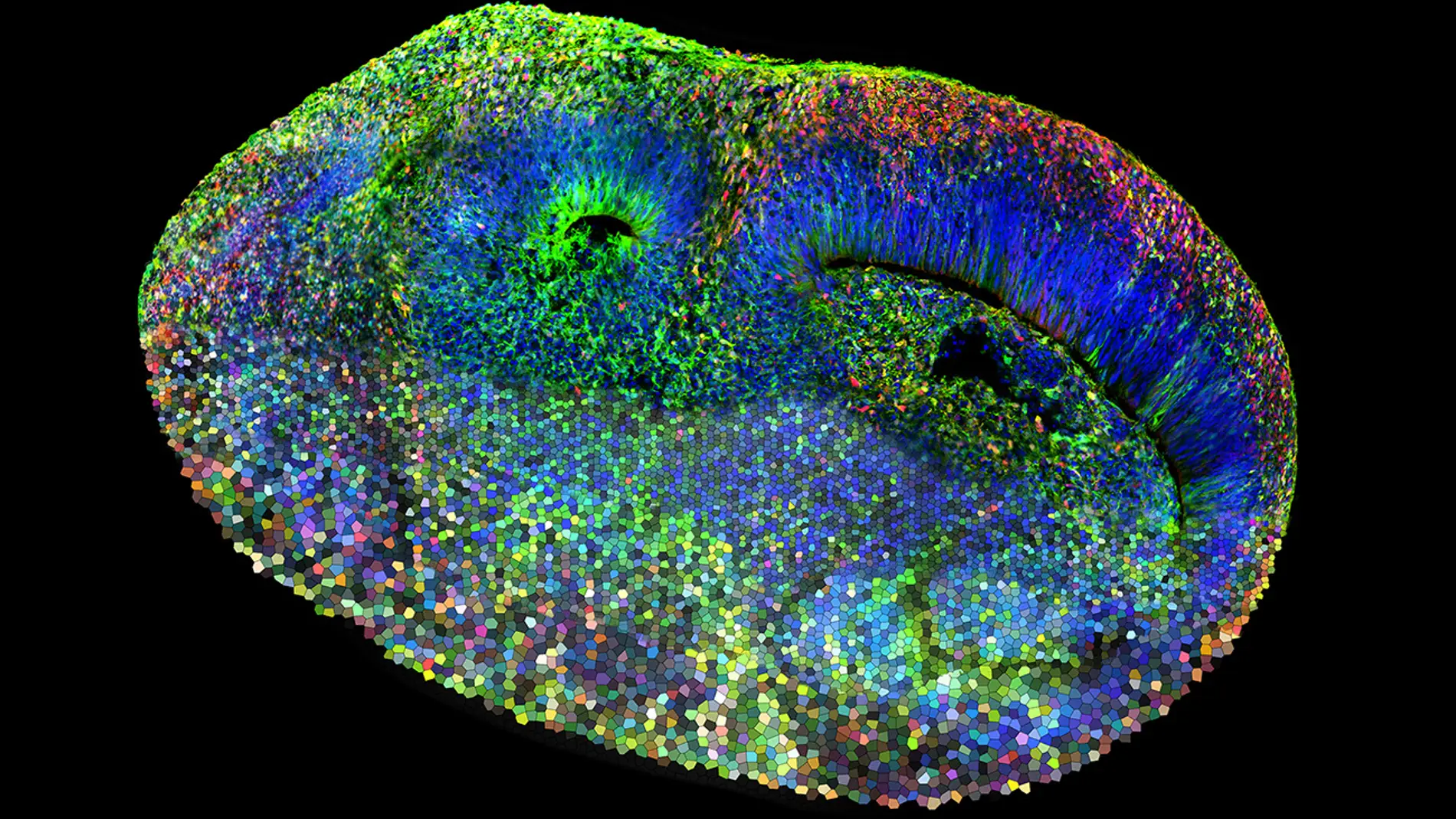 Imagen de un sistema de mosaico de organoides cerebrales humanos CHOOSE