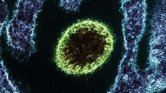 Alerta en el sur de la India tras dos muertes por el mortal virus Nipah. Alerta en el sur de la India tras dos muertes por el mortal virus Nipah.