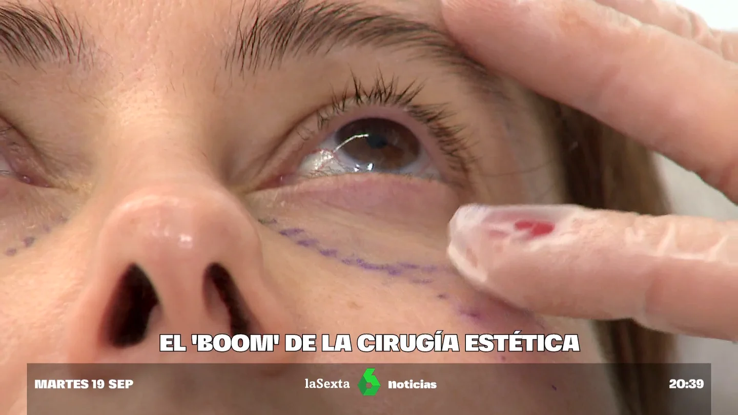 Cirugia Cirugia