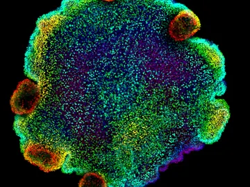 Pequenas criaturas marinas revelan el origen de las neuronas Pequenas criaturas marinas revelan el origen de las neuronas