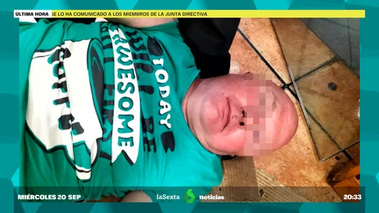 Gastrojeta Gastrojeta