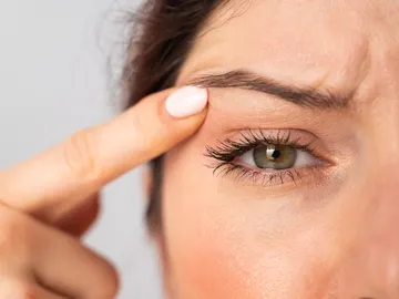 Mujer levantándose el párpado Mujer levantándose el párpado