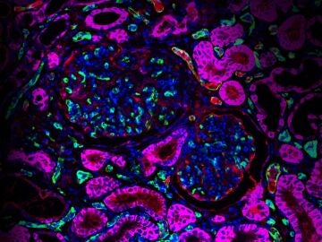 tejido de riñón editado con CRISPR Cas9