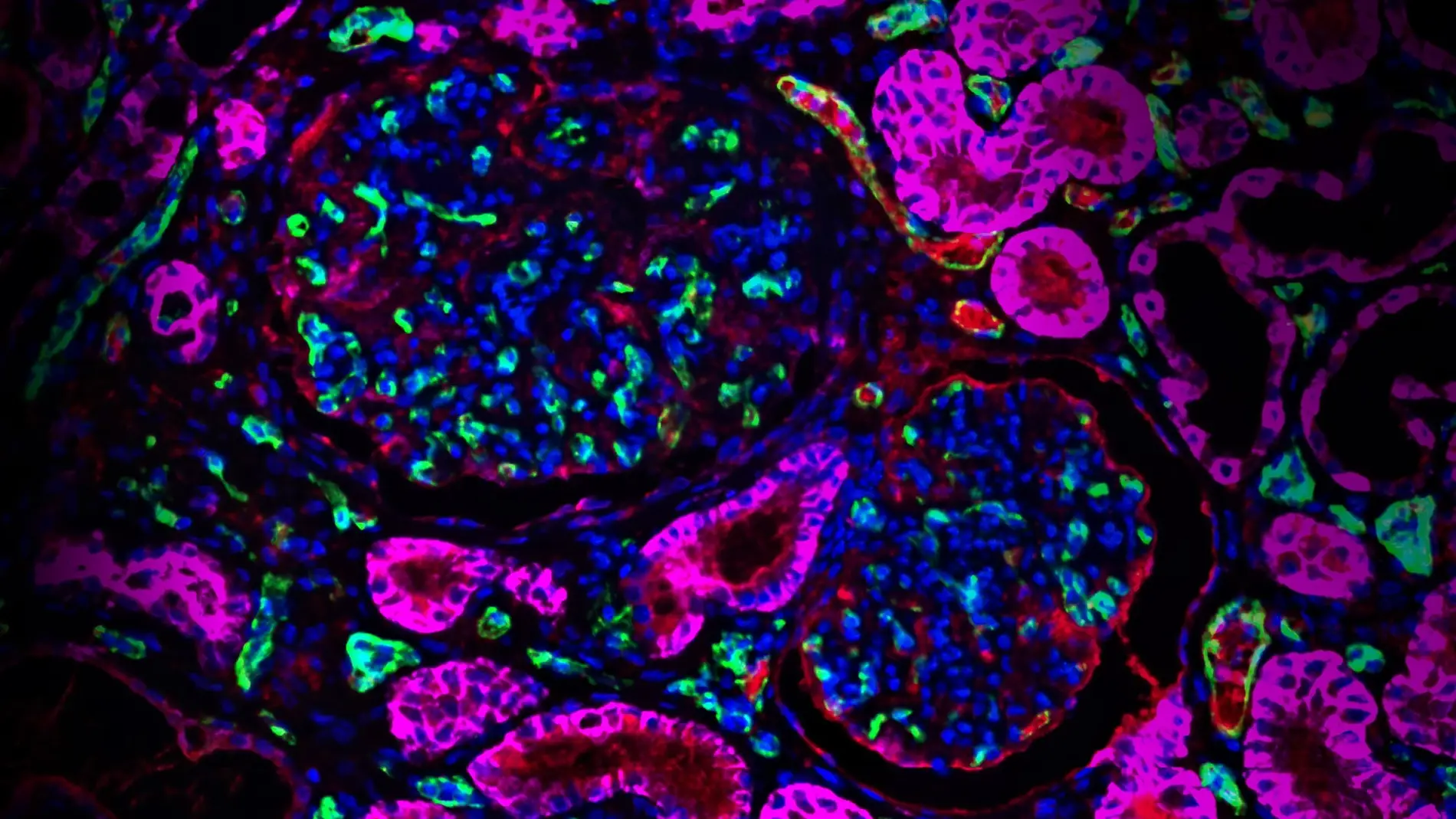 tejido de riñón editado con CRISPR Cas9