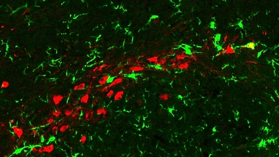Científicos crean el primer "atlas" del cerebro humano que facilita el estudio de enfermedades neurológicas Científicos crean el primer "atlas" del cerebro humano que facilita el estudio de enfermedades neurológicas