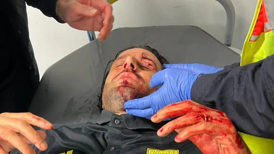 Fabio Grosso, herido Fabio Grosso, herido