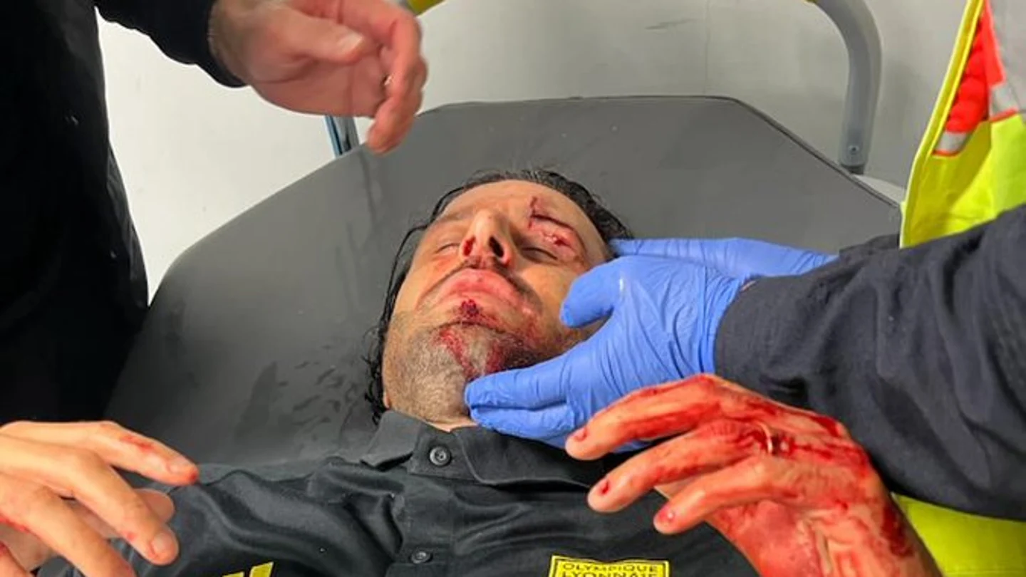 Fabio Grosso, herido Fabio Grosso, herido