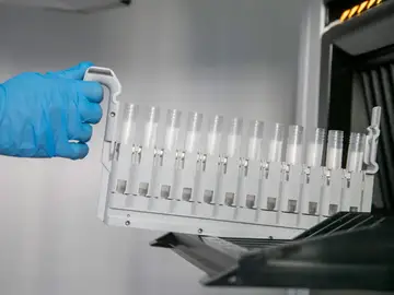 Descubren como se forma y evoluciona la leucemia el segundo cancer de la sangre mas prevalente Descubren como se forma y evoluciona la leucemia el segundo cancer de la sangre mas prevalente