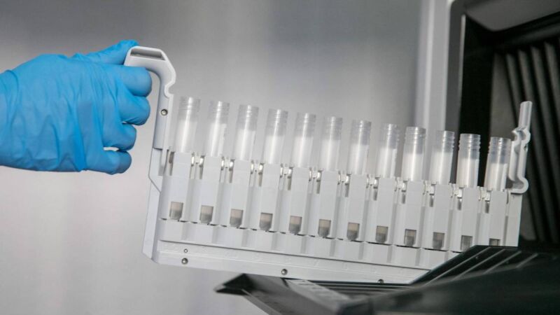 Hacerse un TAC en la juventud eleva el riesgo de padecer cáncer