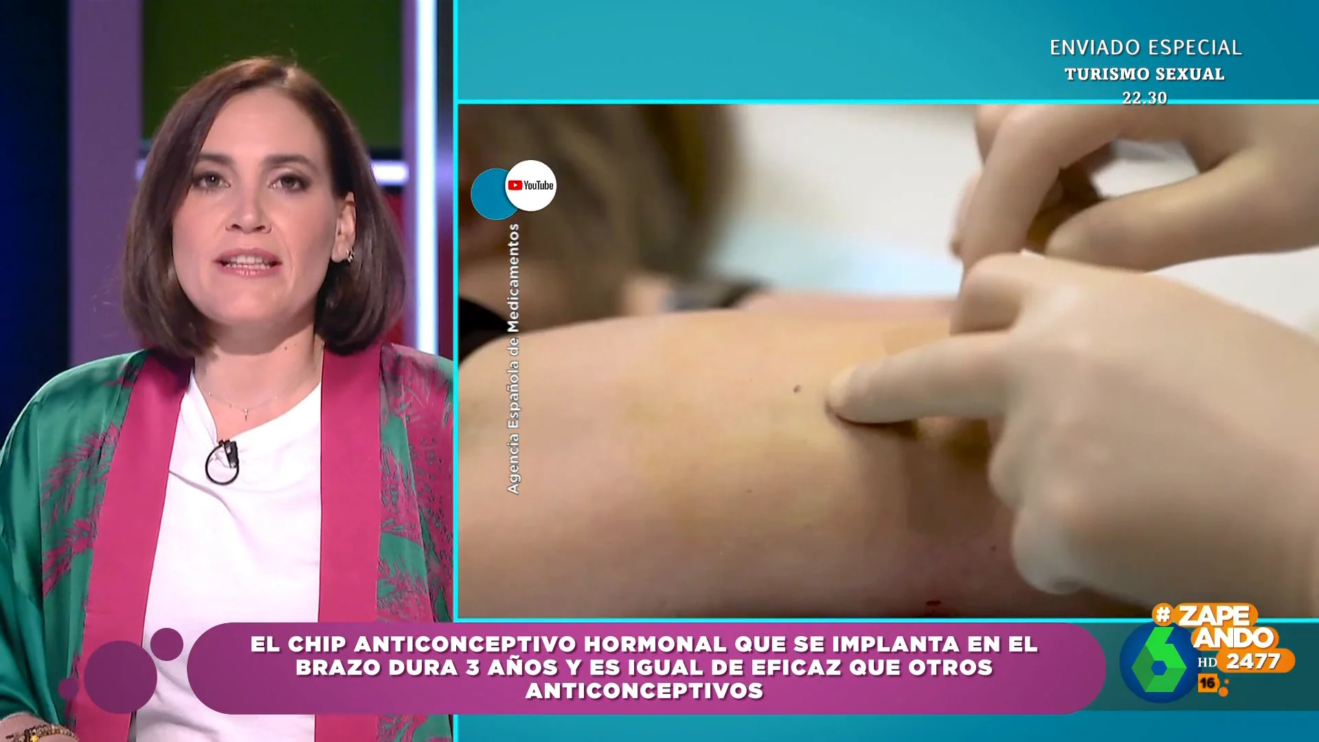 ¿Es eficaz el implante anticonceptivo? Boticaria García indica que se coloca en el brazo y dura tres años