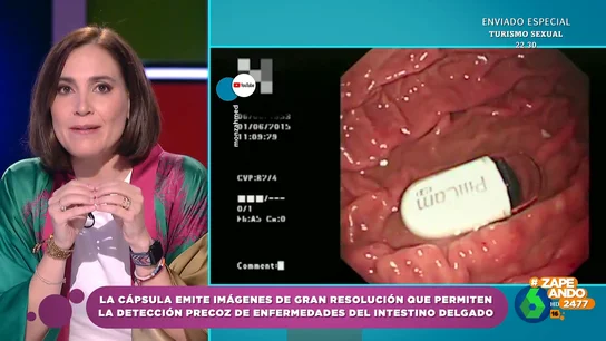 ¿Cómo funciona la cápsula endoscópica? Boticaria García indica que es "el Gran Hermano de nuestras tripas" ¿Cómo funciona la cápsula endoscópica? Boticaria García indica que es "el Gran Hermano de nuestras tripas"