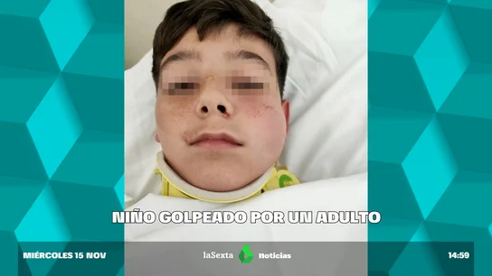 Un adulto golpeo a un niño de 12 años un puñetazo y lo deja inconsciente Un adulto golpeo a un niño de 12 años un puñetazo y lo deja inconsciente