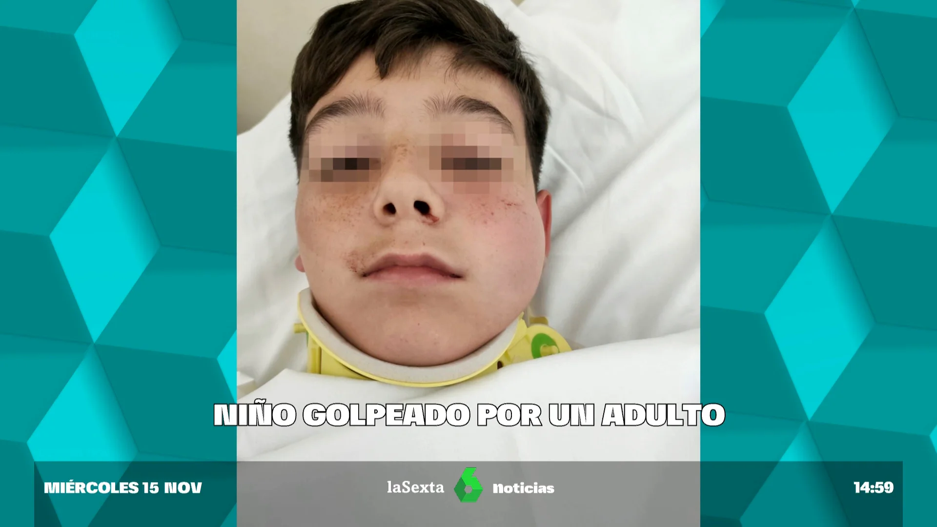 Un adulto golpeo a un niño de 12 años un puñetazo y lo deja inconsciente