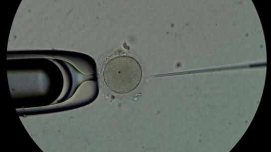 &iquest;Cu&aacute;les son las ciudades espa&ntilde;olas con mejor y peor calidad de esperma? 