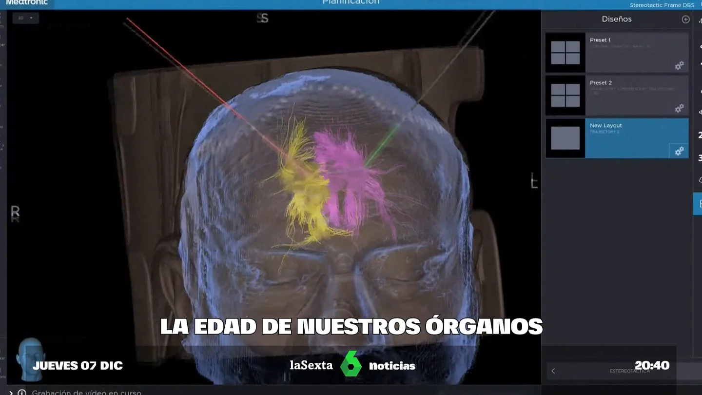 OrganosEnvejecen OrganosEnvejecen
