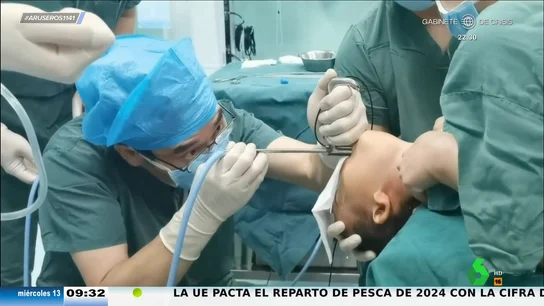 Operan de urgencia a un niño de 2 años tras atragantarse con un cacahuete: este es el vídeo de cómo le salvan la vida Operan de urgencia a un niño de 2 años tras atragantarse con un cacahuete: este es el vídeo de cómo le salvan la vida