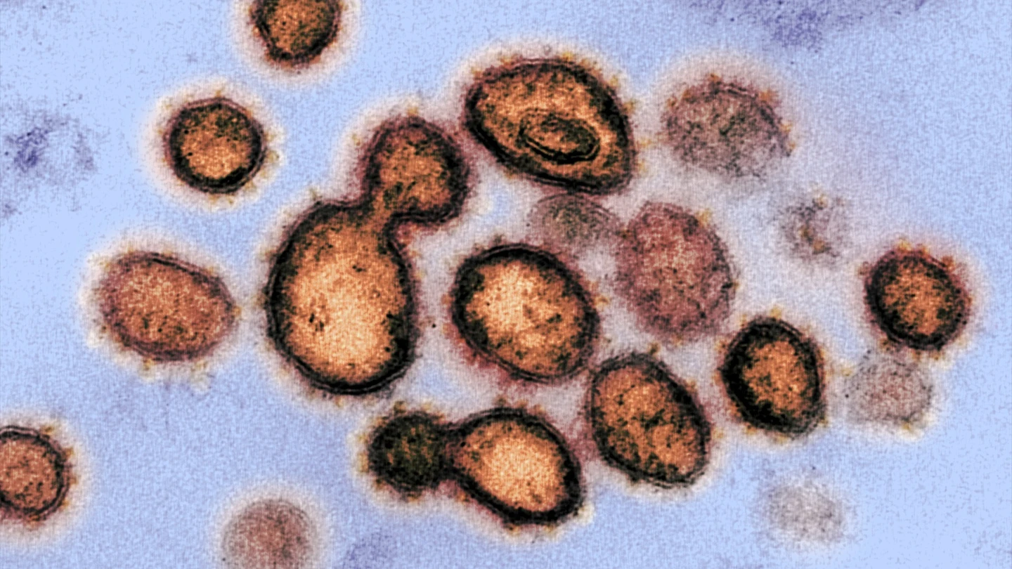 Esta imagen de microscopio electrónico del Instituto estadounidense de Alergia y Enfermedades Infecciosas (NIAID), coloreada digitalmente, muestra el SARS-CoV-2. Esta imagen de microscopio electrónico del Instituto estadounidense de Alergia y Enfermedades Infecciosas (NIAID), coloreada digitalmente, muestra el SARS-CoV-2.