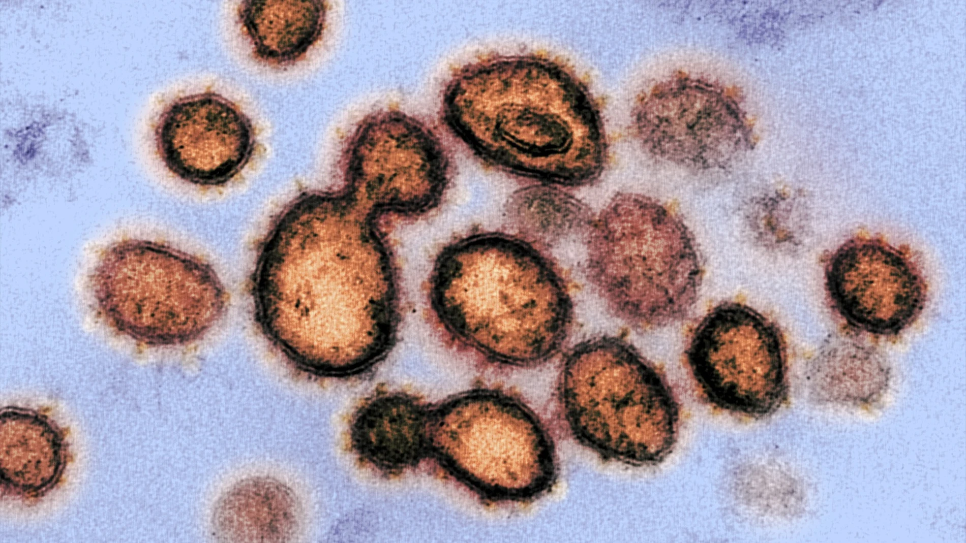 Esta imagen de microscopio electrónico del Instituto estadounidense de Alergia y Enfermedades Infecciosas (NIAID), coloreada digitalmente, muestra el SARS-CoV-2.