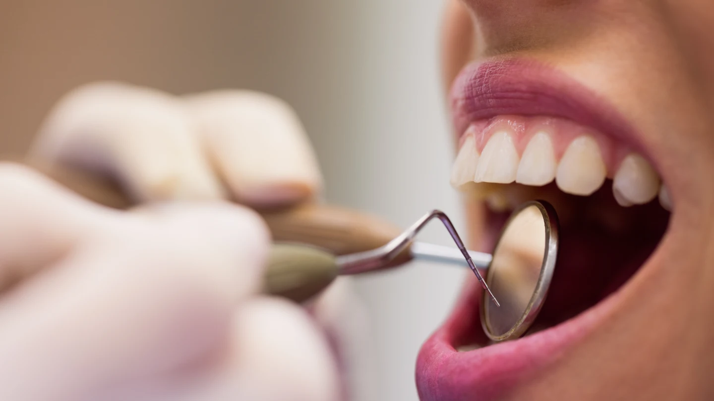 Una mujer en el dentista. Una mujer en el dentista.