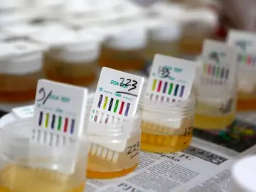 Muestras de orina pendientes de analizar Muestras de orina pendientes de analizar