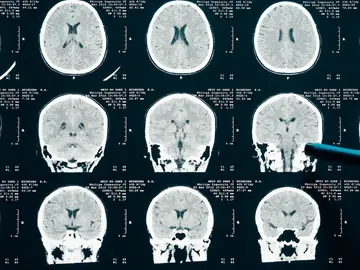Cerebro Cerebro