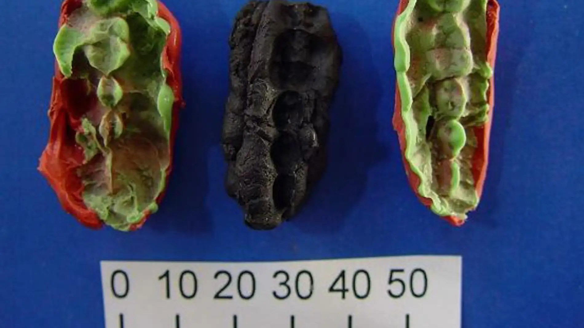 Las caries y las enfermedades de las encías ya inquietaban al hombre hace 10.000 años