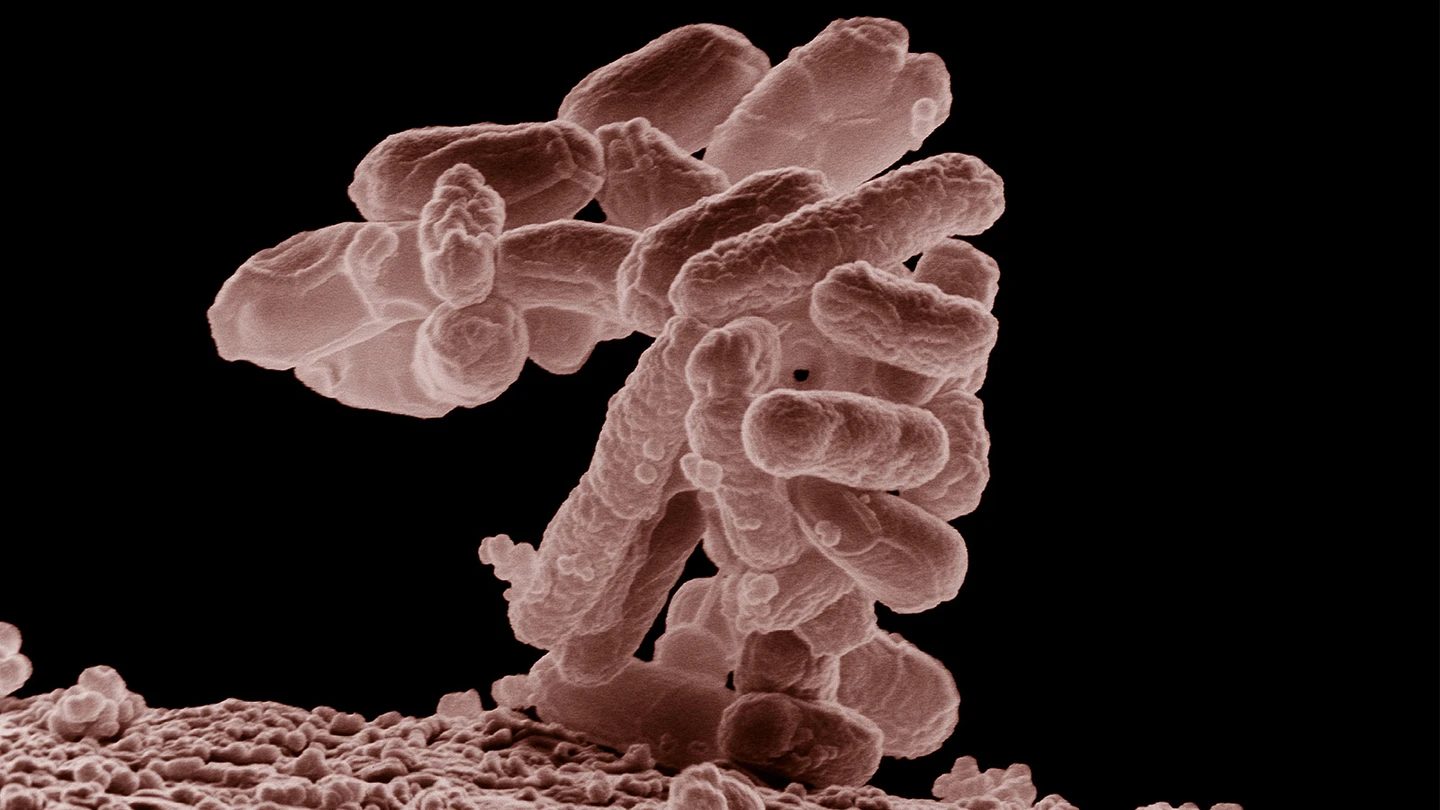 bacteria E. Coli bacteria E. Coli