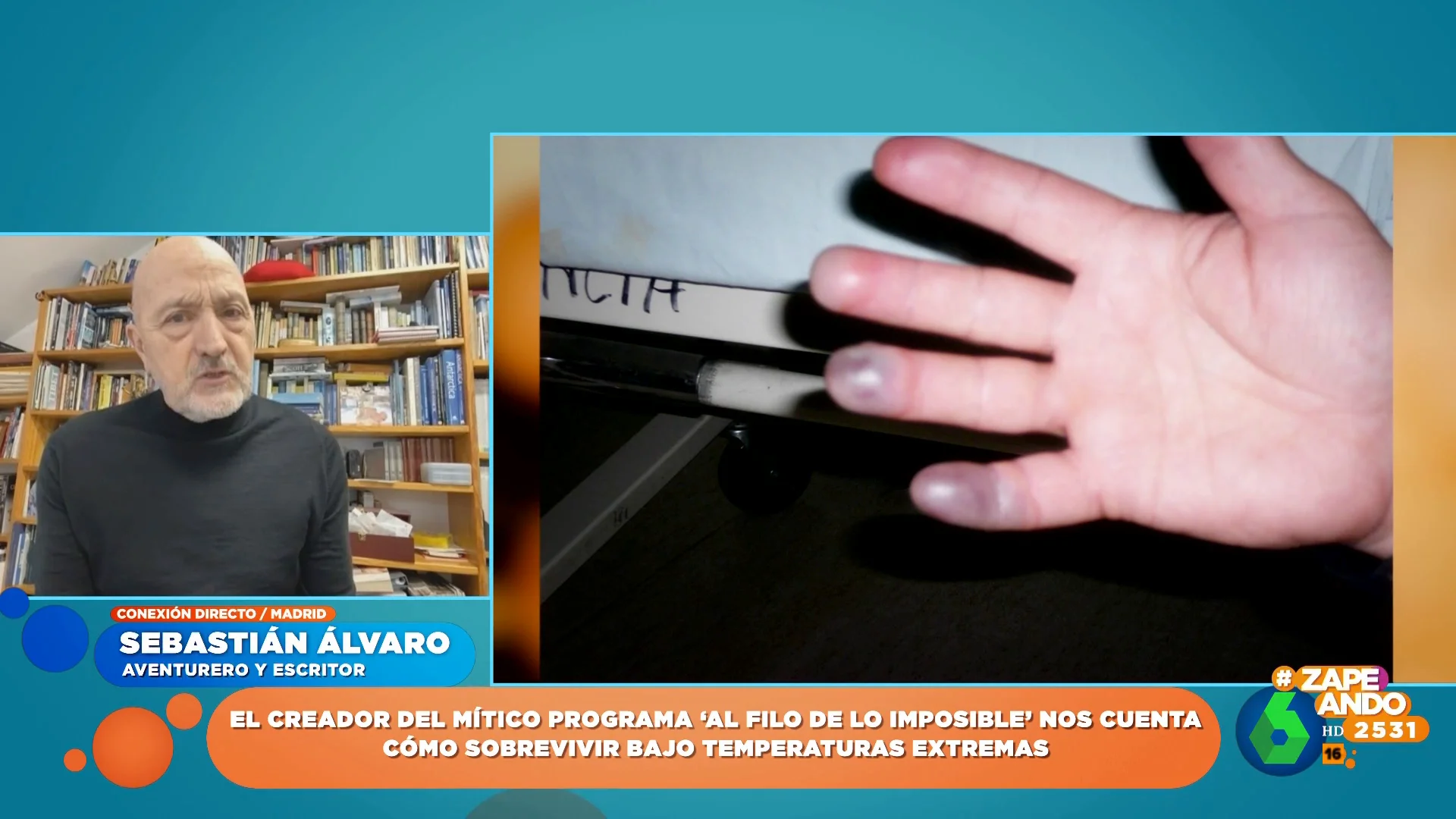 Sebastián Álvaro cuenta su experiencia con las congelaciones en la montaña: "Tengo todavía todos los dedos, pero los tengo tocados"