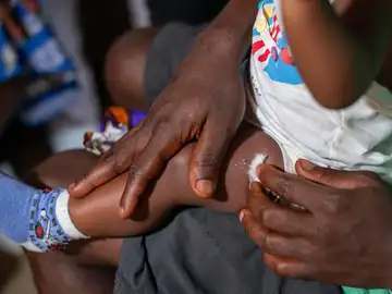 Una madre sostiene a su hijo tras recibir la vacuna contra la malaria en el Centro Médico de Nyalla en Douala, Camerún, 22 de enero de 2024.