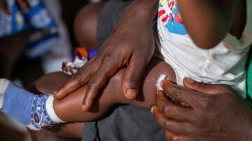 Una madre sostiene a su hijo tras recibir la vacuna contra la malaria en el Centro Médico de Nyalla en Douala, Camerún, 22 de enero de 2024.