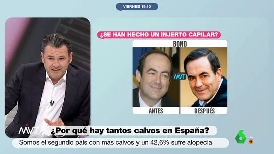 Iñaki López, sobre el injerto capilar de José Bono: "Me parece muy bien que desdramatice..." Iñaki López, sobre el injerto capilar de José Bono: "Me parece muy bien que desdramatice..."