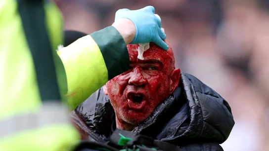 Un aficionado, herido en los incidentes en el WBA - Wolverhampton Un aficionado, herido en los incidentes en el WBA - Wolverhampton