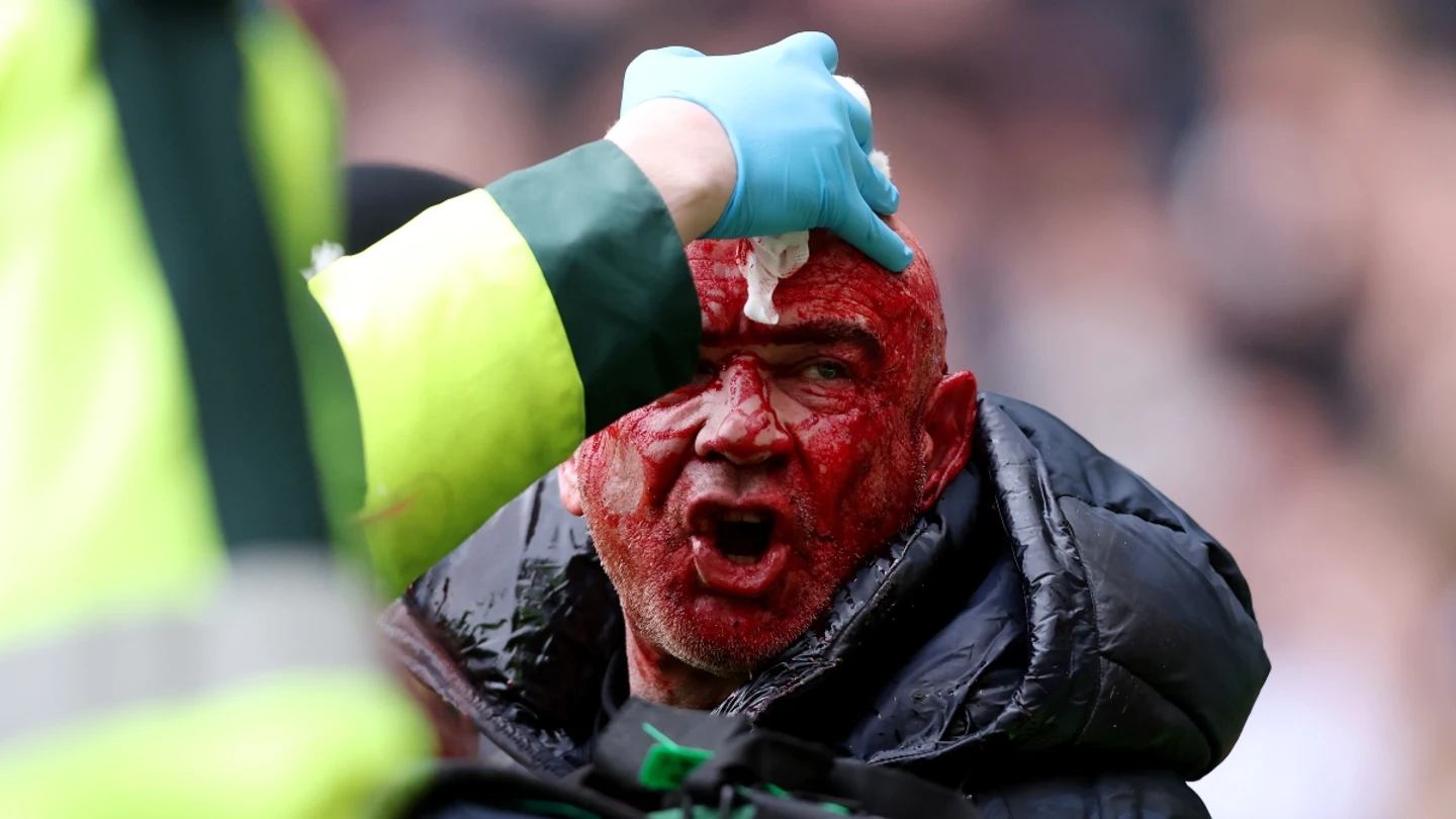 Un aficionado, herido en los incidentes en el WBA - Wolverhampton Un aficionado, herido en los incidentes en el WBA - Wolverhampton
