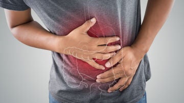 Cáncer colon
