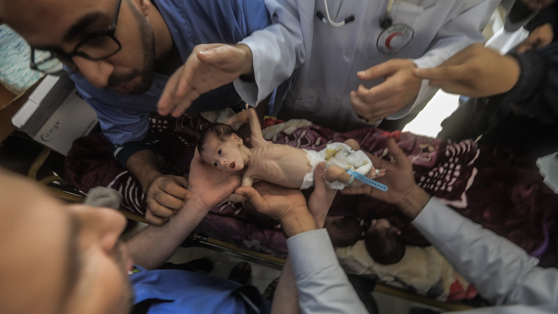 Médicos palestinos en un hospital de Rafah preparan a un bebé prematuro para ser trasladado a Egipto 