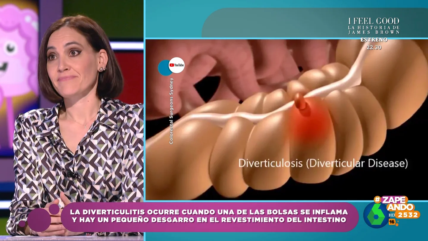 Boticaria García desvela quiénes presentan más riesgos de sufrir diverticulitis Boticaria García desvela quiénes presentan más riesgos de sufrir diverticulitis
