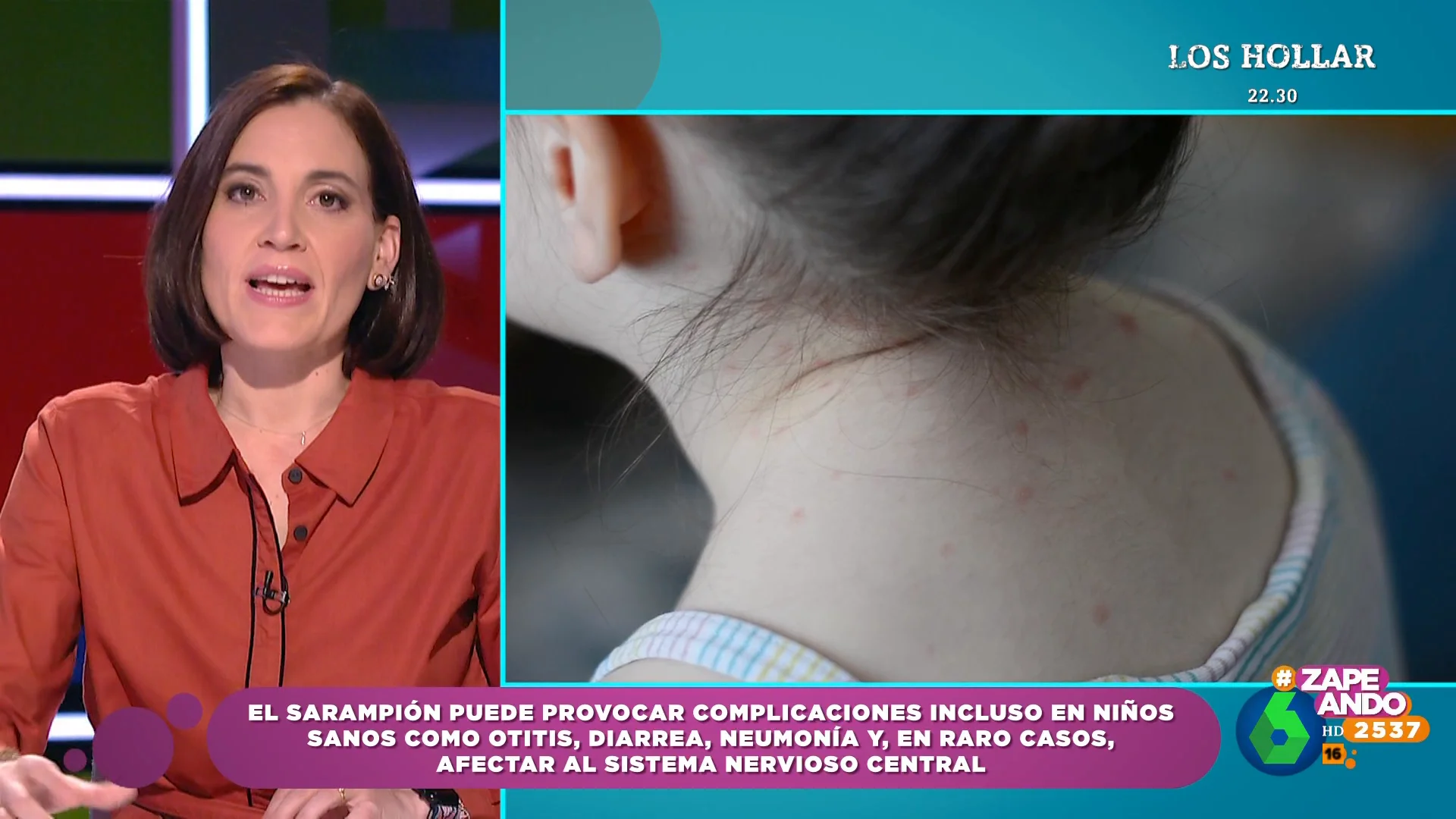 ¿Qué diferencias hay entre el sarampión y la varicela? Boticaria García lo aclara en Zapeando