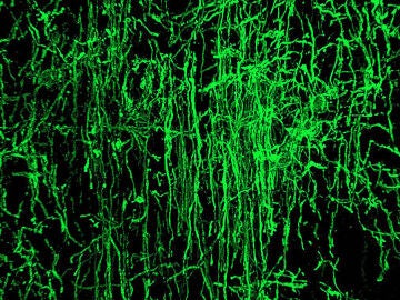 Oligodendrocitos como estos (en verde) se encargan de mielinizar los axones neuronales