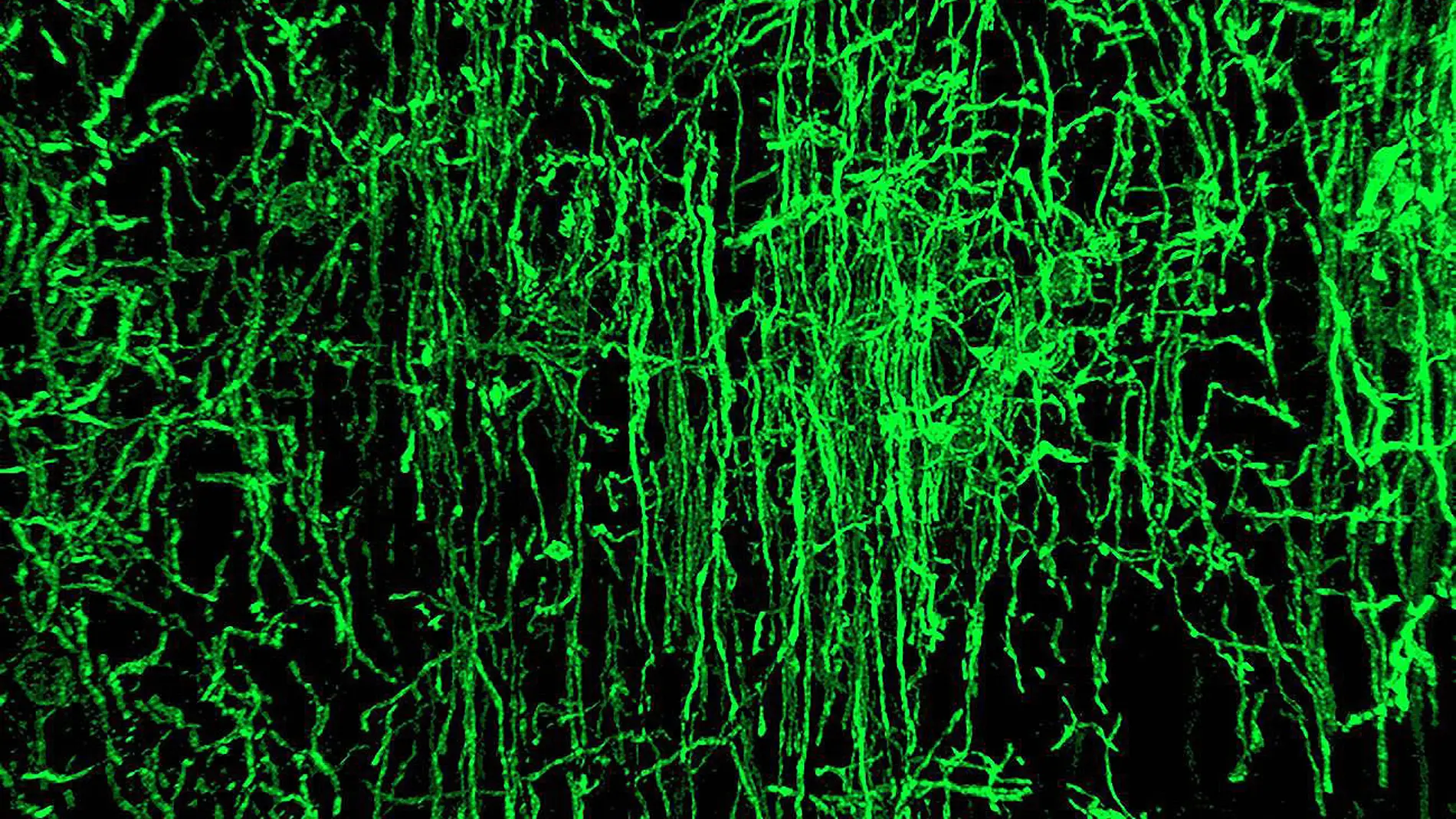 Oligodendrocitos como estos (en verde) se encargan de mielinizar los axones neuronales
