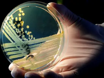 Descubren una molécula contra bacterias resistentes a los antibióticos Descubren una molécula contra bacterias resistentes a los antibióticos