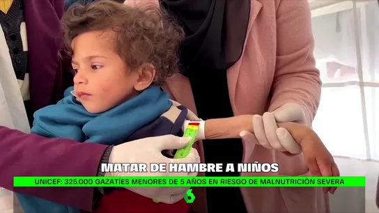 La devastadora situación en Gaza: 325.000 gazatíes menores de 5 años en riesgo de malnutrición severa La devastadora situación en Gaza: 325.000 gazatíes menores de 5 años en riesgo de malnutrición severa