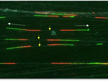 oléculas de ADN en proceso de copiado en células humanas oléculas de ADN en proceso de copiado en células humanas