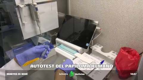 Test de autodiagnóstico del virus del papiloma humano: se entregará gratis en las farmacias catalanas a las mujeres a partir de 30 años