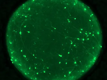 organoide cerebral organoide cerebral