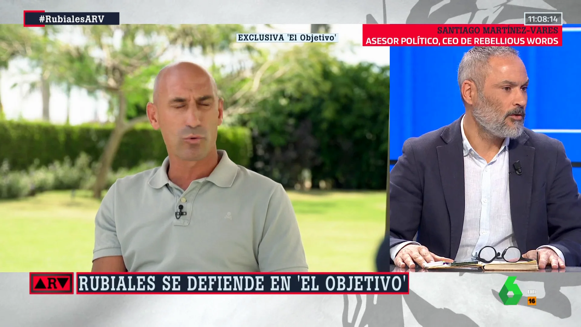 ARV - Santiago Martínez-Vares