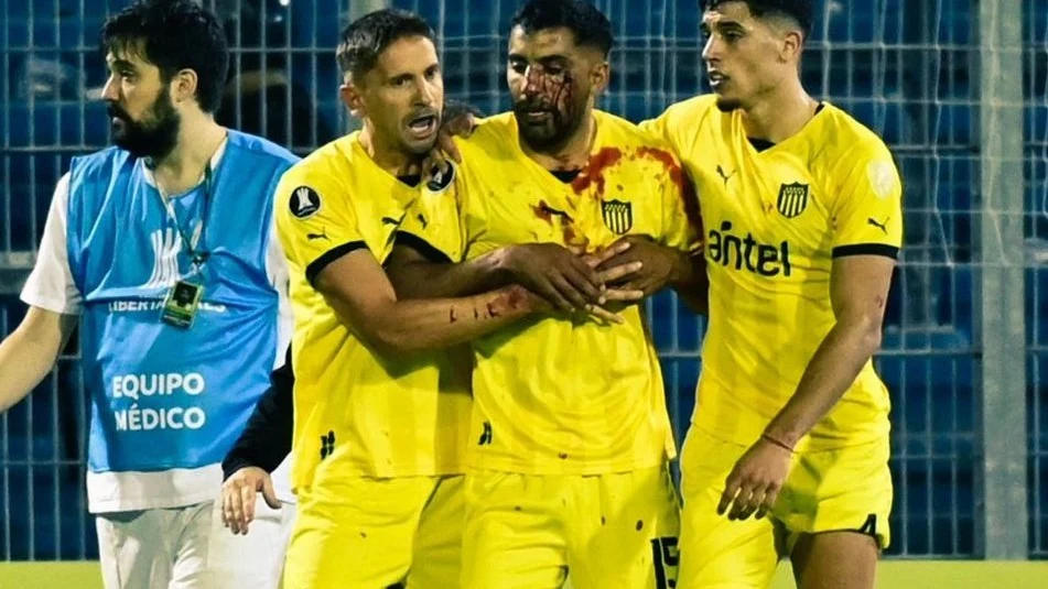 Maximiliano Olivera, con la cara ensangrentada