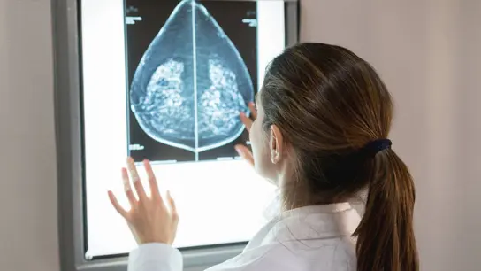 Una doctora observando una imagen de cáncer de mama.  Cáncer de mama.