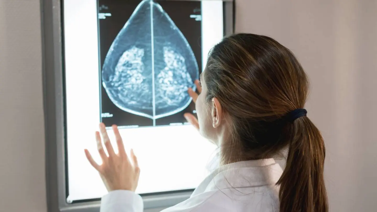 Una doctora observando una imagen de cáncer de mama. Cáncer de mama.