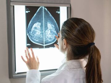 Una doctora observando una imagen de cáncer de mama. 